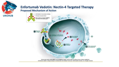Первое испытание на людях внутрипузырного введения энфортумаба ведотина (EV)