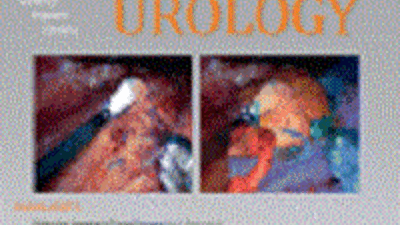 Систематический обзор связи между эректильной дисфункцией и сердечно-сосудистыми заболеваниями