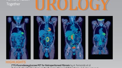 Высокая вероятность позднего восстановления функции мочеиспускания и эрекции более чем через 12 месяцев после радикальной простатэктомии