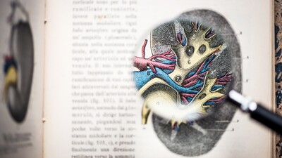 KIM-1 является наиболее сильным предиктором прогрессирования почечной недостаточности