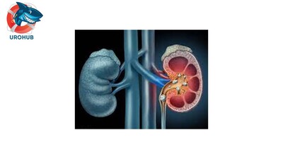 Прегабалин при уретероскопии: слепое плацебо-контролируемое исследование