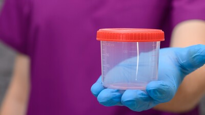 Стоит ли делать посев мочи перед операцией простаты? Новые данные