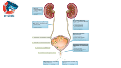Эффективность методов лечения осложнённых инфекций мочевыводящих путей, включая острый пиелонефрит: систематический обзор и сетевой метаанализ