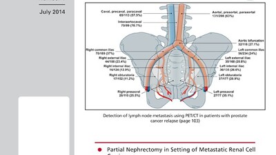 Использование преоперативного контрольного перечня снижает риск инфекции пенильного протеза