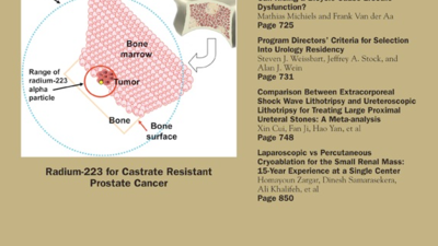 Практичность рекомендаций ВОЗ 2010 для оценки показаний к варикоцелэктомии