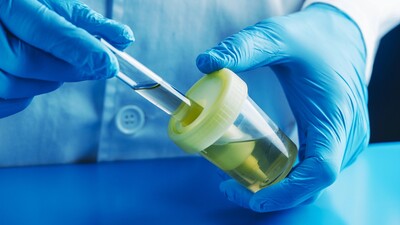 Простой алгоритм назначения посева мочи: сначала посмотрите на лейкоциты