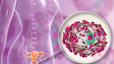 Присутствие бактерий рода Gardnerella в моче увеличивает риск рецидивирующей ИМП при определенных условиях