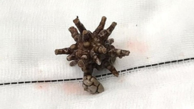 Исследователи детально изучили морфологию шиповатых камней.