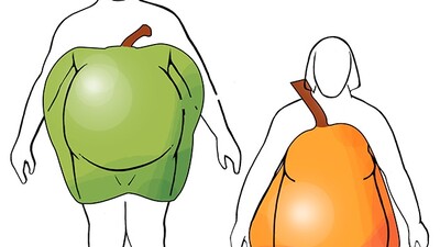 Исследователи изучили связь между метаболическим синдромом и оксалатной МКБ