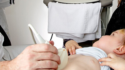 Ретроградную интраренальную хирургию можно рассматривать в качестве вмешательства первой линии в педиатрической практике