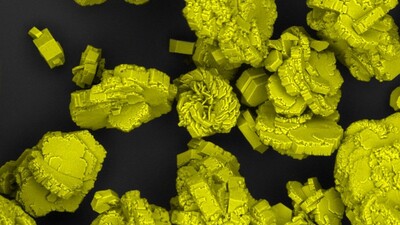 Ретроградная интраренальная хирургия является эффективным и безопасным методом лечения цистиновой МКБ у детей