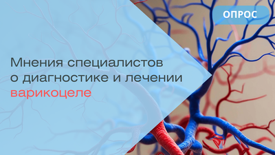 Поделитесь Вашим профессиональным мнением о диагностике и лечении варикоцеле