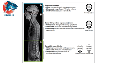 Клинические рекомендации ЕАУ по нейроурологии 2022 г.