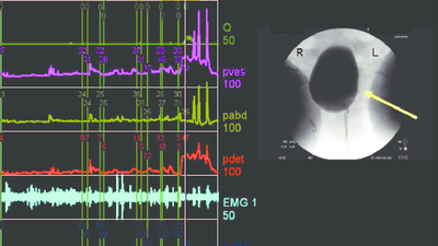 Какие факторы определяют продолжительность применения альфа-блокаторов?