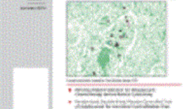 Эффективность операции Т-шунтирования и интракавернозного туннелирования (прием «змеи») по поводу рефрактерного ишемического приапизма