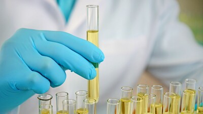 Диагностическая ценность мочи после приема антибиотиков