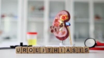 Метаболические нарушения у пациентов с чистыми и смешанными струвитными камнями: обработка данных с помощью LLM