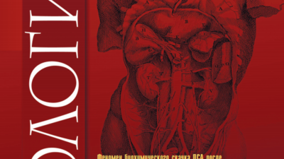 Эмболизация вен простатического сплетения в лечении веногенной эректильной дисфункции (клинические случаи)