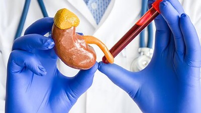 Высокий уровень креатинина в моче может быть предиктором МКБ