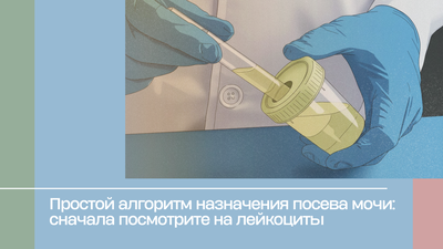 Простой алгоритм назначения посева мочи: сначала посмотрите на лейкоциты