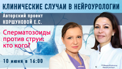10 июня в 16.00 мск! Сперматозоиды против струи: кто кого?