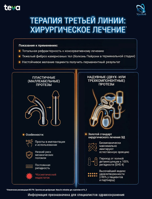 Оценка ригидности полового члена