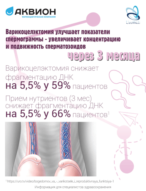 Варикоцеле и мужская фертильность