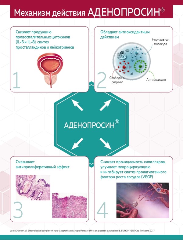 Шаги к улучшению качества жизни пациентов: эффективная терапия симптомов нижних мочевых путей