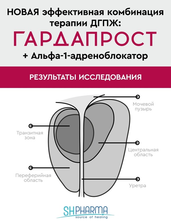 НОВАЯ эффективная комбинация терапии ДГПЖ: ГАРДАПРОСТ +  Alfa-1-адреноблокатор. Результаты исследования