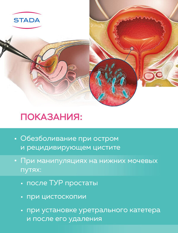 Феназалгин