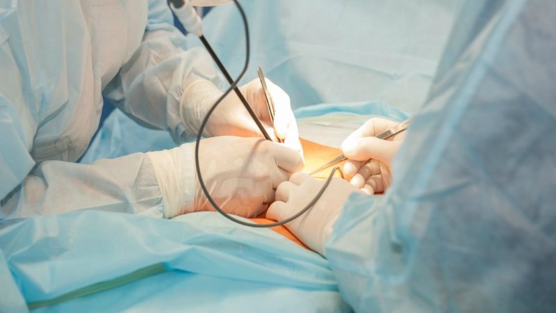 Факторы риска инфекции мочевых путей после уретральной слинговой хирургии