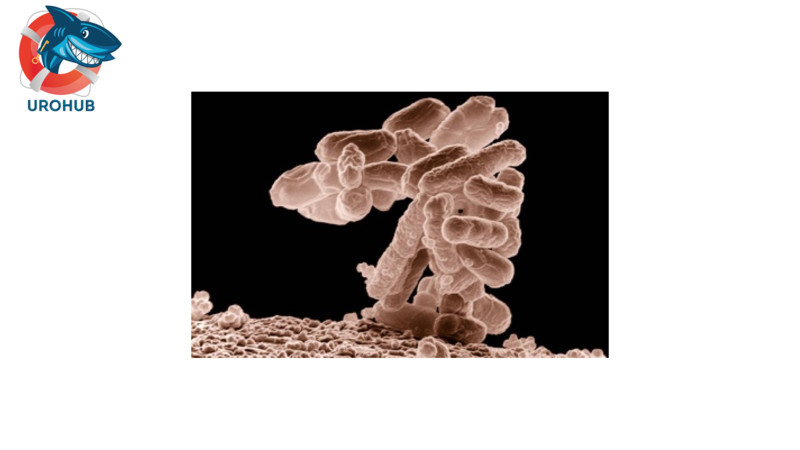 Случай острого бактериального цистита, вызванного CO2-зависимой кишечной палочкой