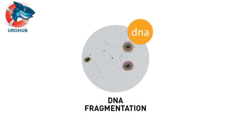 Варикоцеле и фрагментация ДНК сперматозоидов: новые доказательства с применением в клинической практике