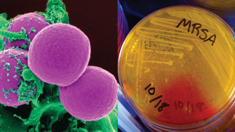 Распространенность и факторы риска бактериемии у пациентов с бактериурией, вызванной Staphylococcus aureus: ретроспективное когортное исследование