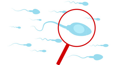 Новая таргетная терапия азооспермии