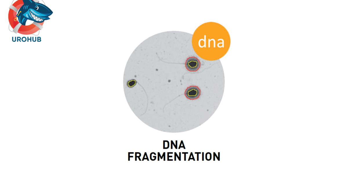 Анализ на фрагментацию ДНК сперматозоидов