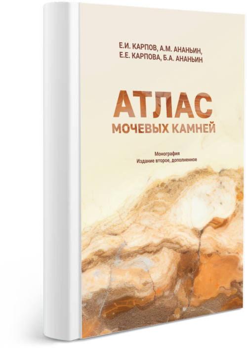Атлас мочевых камней