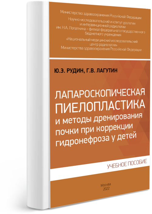 Лапароскопическая пиелопластика и методы дренирования почки при коррекции гидронефроза у детей