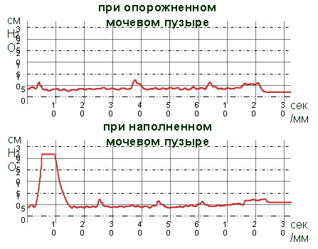 Необструктивная форма