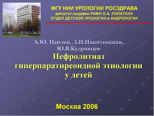 Нефролитиаз гиперпаратиреоидной этиологии у детей