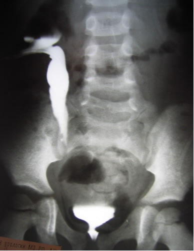 UroWeb ru UroWeb ru