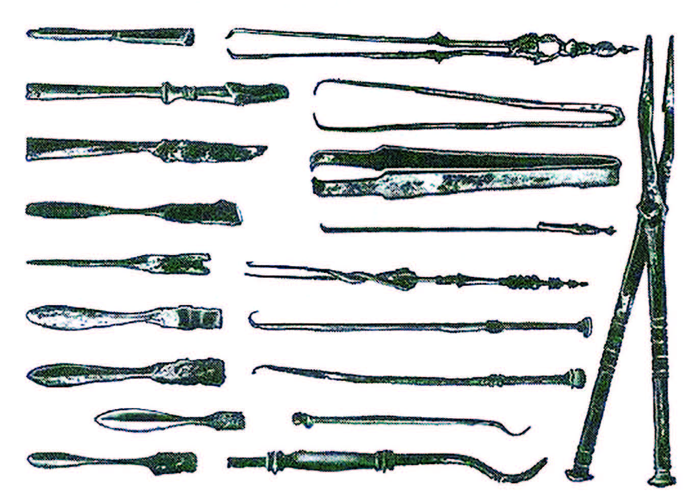Хирургические инструменты древней Греции и Рима